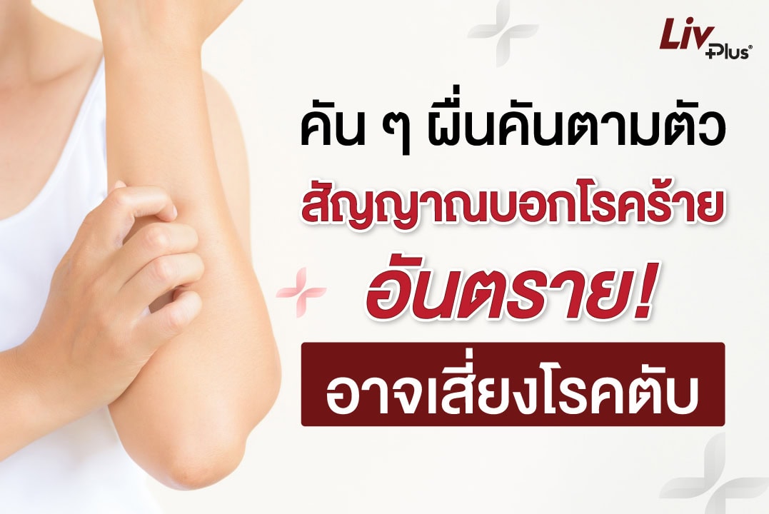 Read more about the article อาการคัน: สัญญาณเตือนภาวะผิดปกติของร่างกาย รวมถึงภาวะตับ